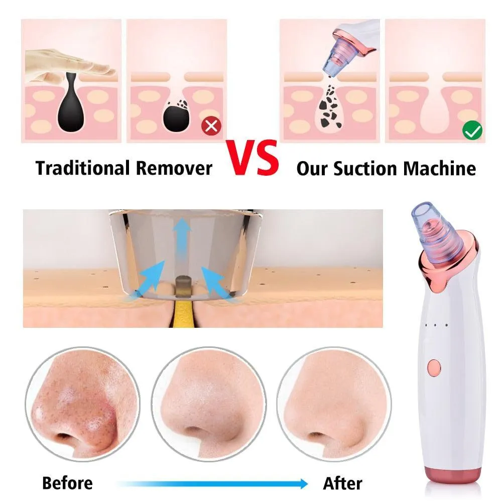 Facial Blackhead Remover Electric Acne Cleaner Blackhead Black Point